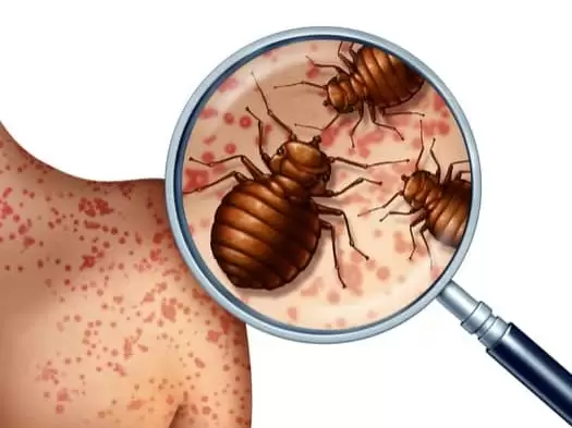 Pest Kill India Pvt Ltd